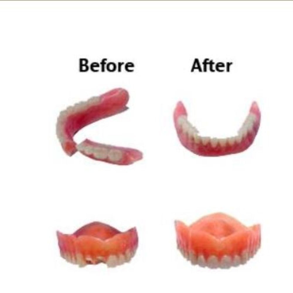 Professional Grade Denture Repair Kit Glue Q372