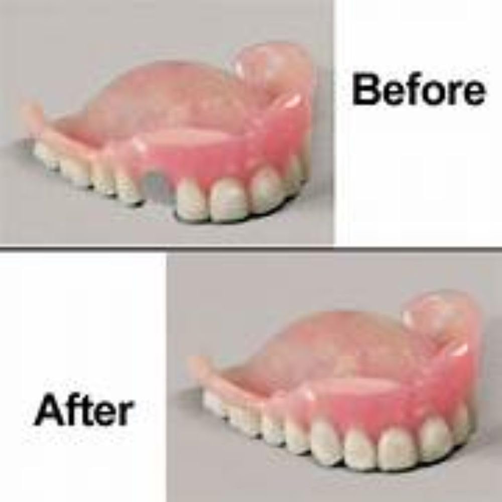 Professional Grade Denture Repair Kit Glue Q372