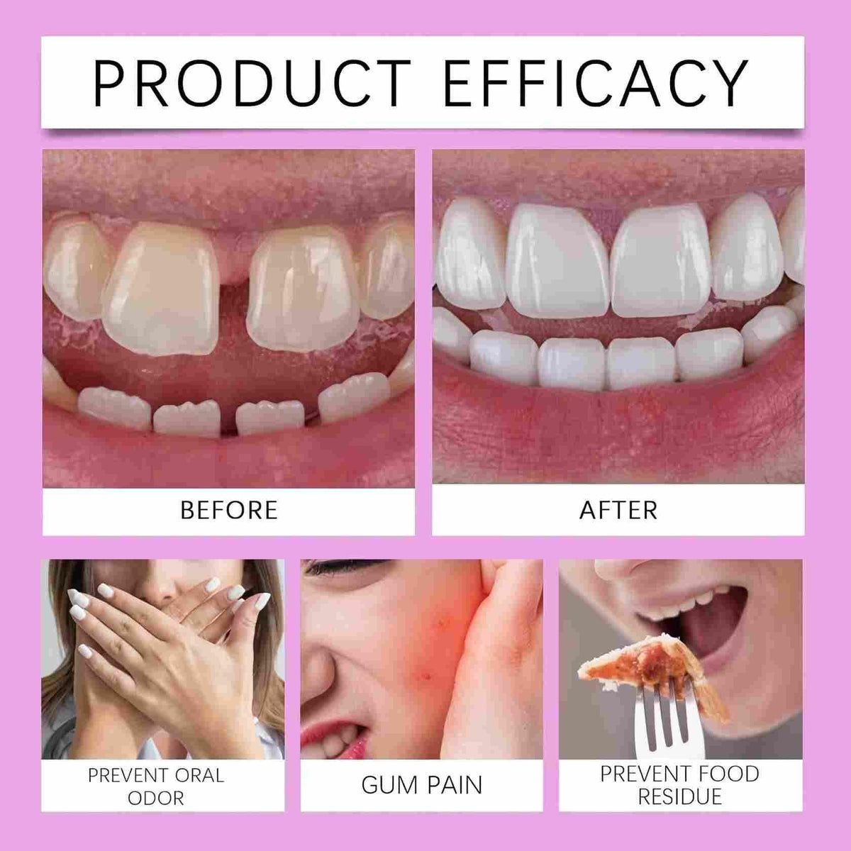 Adjustable Silicone Full-Mouth Denture Set G701